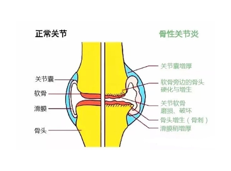 益节氨糖钙片服用方法